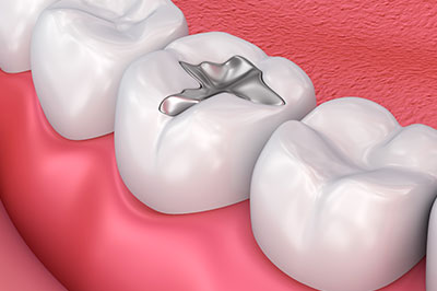 Synergy Dental Specialists | Periodontal Treatment, Bone Grafts and Extractions