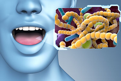 Synergy Dental Specialists | Sinus Lifts, Periodontal Treatment and TMJ Disorders