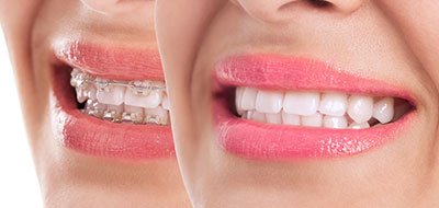 Synergy Dental Specialists | Oral Exams, Scaling   Root Planing and Periodontic Plastic Surgery