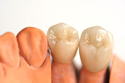 Synergy Dental Specialists | Oral   Facial Trauma, Periodontic Plastic Surgery and Extractions