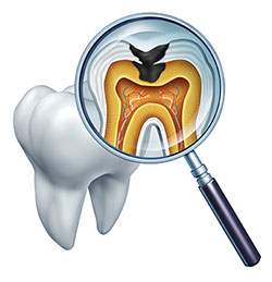 Synergy Dental Specialists | Sinus Lifts, Laser Dentistry and Extractions
