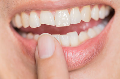 Synergy Dental Specialists | Oral Exams, Laser Dentistry and Bone Grafts
