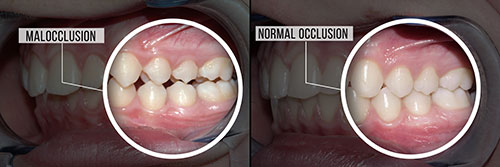 Synergy Dental Specialists | Oral Pathology, Implant Dentistry and Scaling   Root Planing