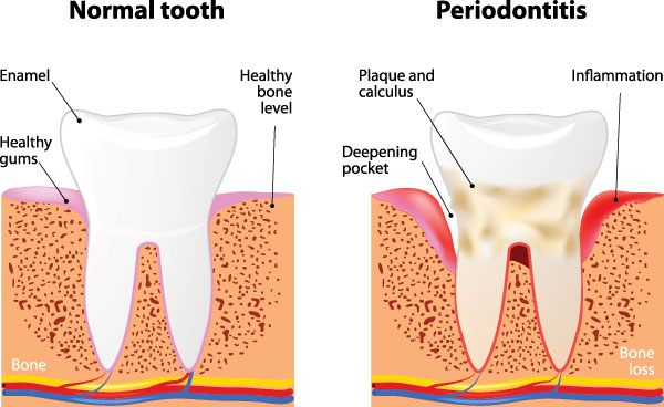 Synergy Dental Specialists | Corrective Jaw Surgery, Oral   Facial Trauma and Periodontal Treatment