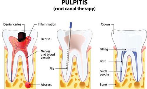 Synergy Dental Specialists | Ridge Augmentation, Oral Cancer Screening and Scaling   Root Planing