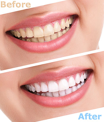 Synergy Dental Specialists | Oral Pathology, Periodontic Plastic Surgery and Preventative Program