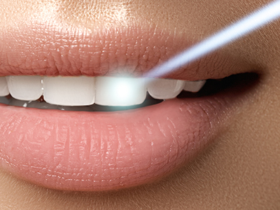 Synergy Dental Specialists | Ridge Augmentation, Preventative Program and Implant Dentistry