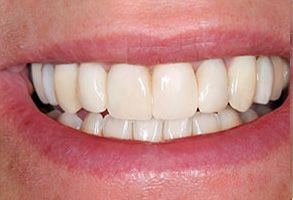 Synergy Dental Specialists | Implant Dentistry, Wisdom Teeth Removal and Oral   Facial Trauma